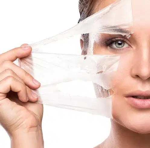 Peeling Químico no Rio de Janeiro