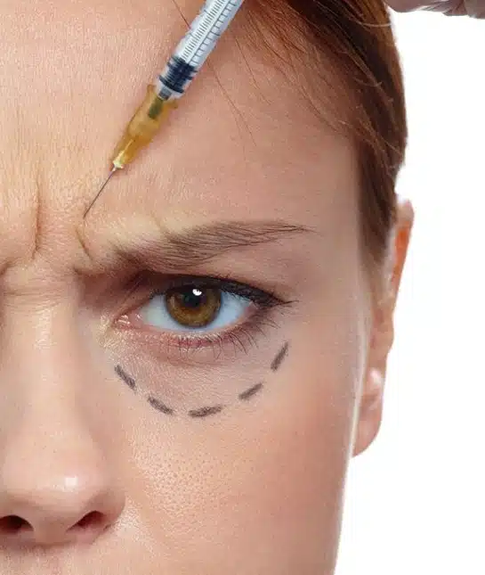 Toxina Botulínica no Rio de Janeiro