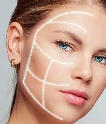 Ultraformer 3 no Rio de Janeiro